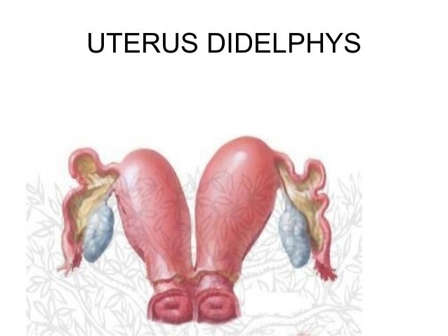 Uterine anomalies