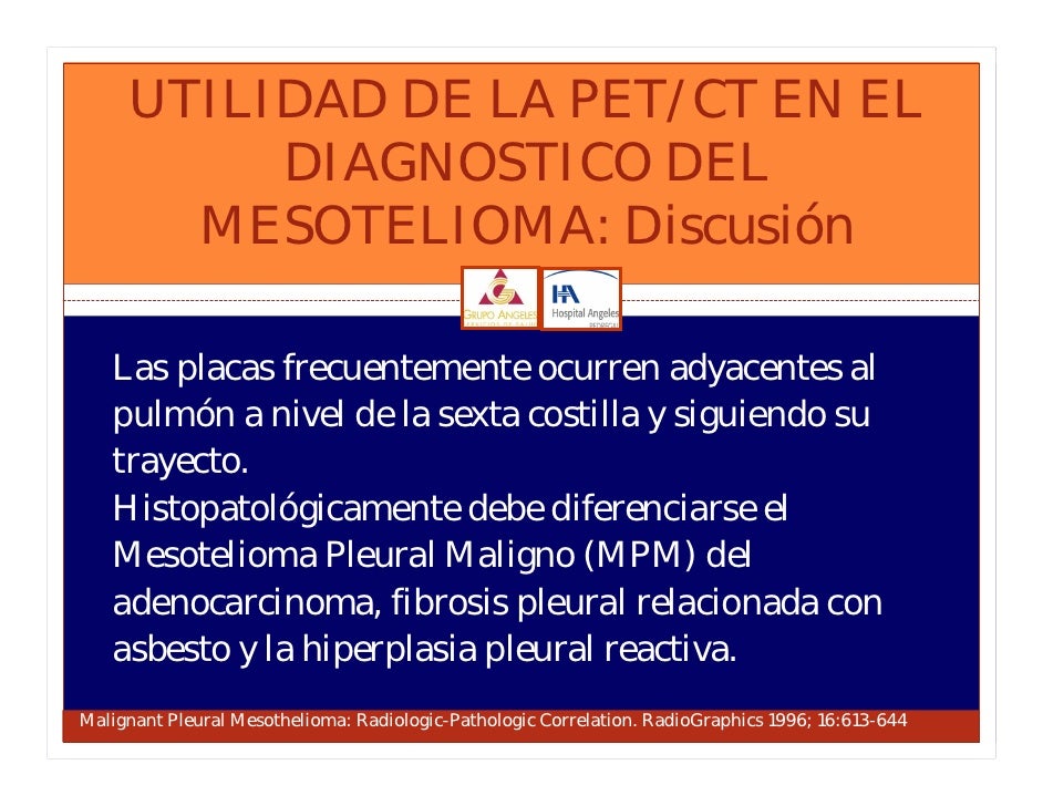Mesothelioma Pleura Ct