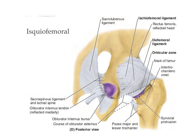 Bursitis Trochanterica