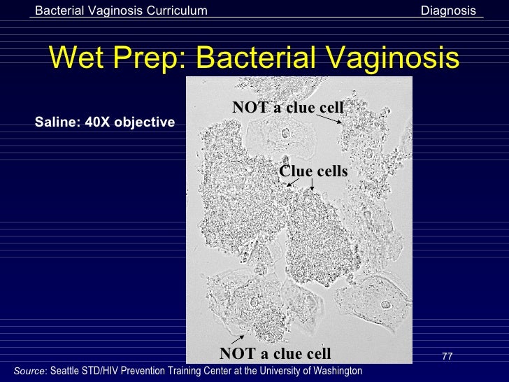 b bacterial vaginosis intro. b bacterial vaginosis intro.