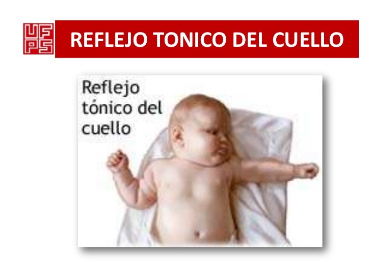 Protruzy la hernia de los discos intervertebrales que este tal
