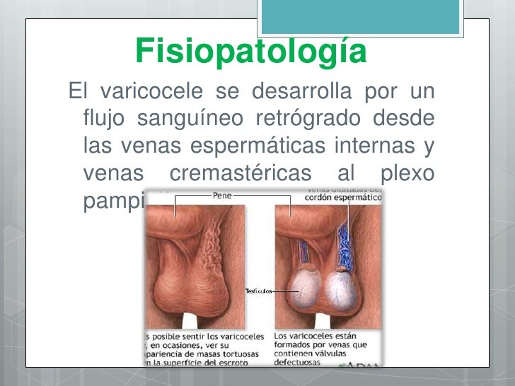 Los ejercicios físicos que aumentan el miembro viril