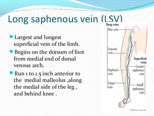 Varicose vein ppt (thu)