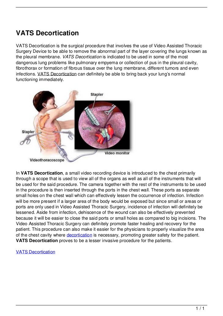 VATS Decortication