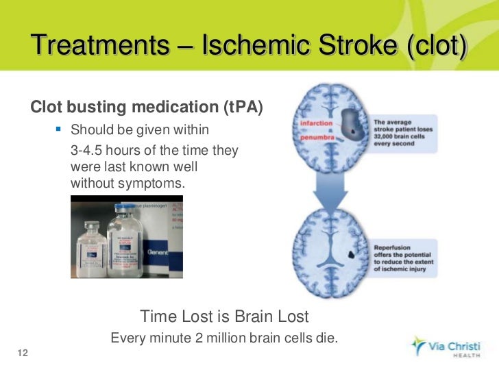 Via Christi Women's Connection What is stroke?