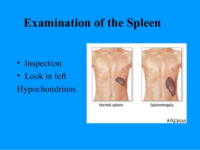 adam stroke disorder