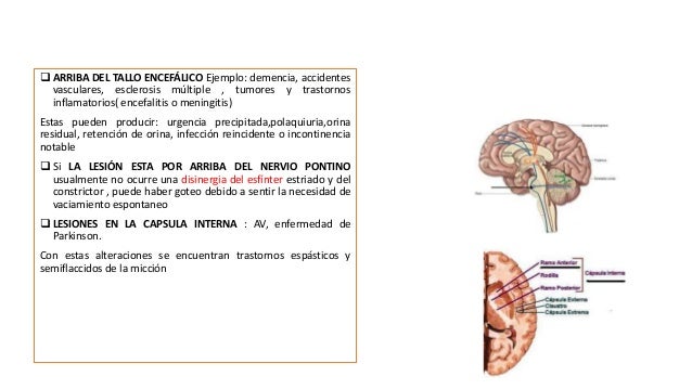 Los ejercicios a la osteocondrosis lumbar y la hernia de la columna vertebral