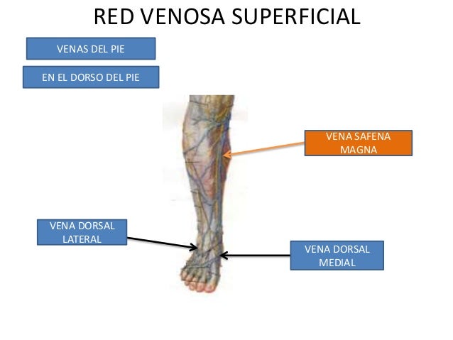 La trombosis de la arteria femoral la clínica