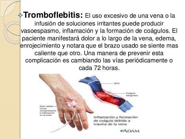 Cuesta cuanto a la operación en varikoz