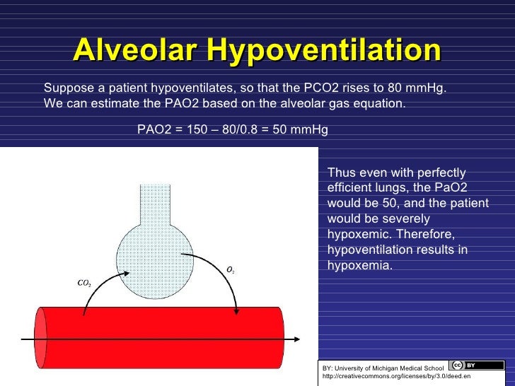Ventilation Perfusion Matching