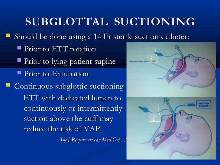 Ventilator associated pneumonia