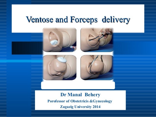download quality improvement in