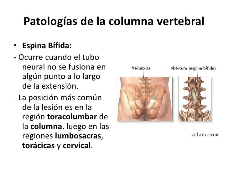 Spondiloartroz los síntomas el tratamiento sheynogo del departamento de la columna vertebral