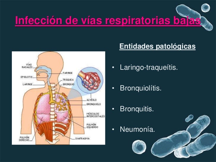 Vias resp bajas Vias resp bajas