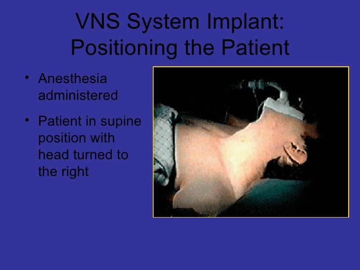 Vns Therapy™ System For Weikong For Print
