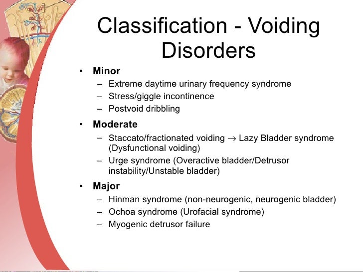 post void dribble syndrome post void dribble syndrome