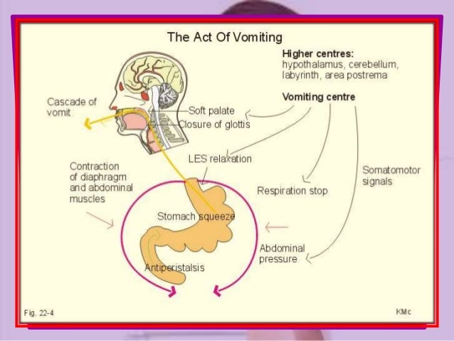 not and vomiting vomiting not and vomiting vomiting