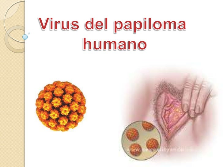 Vph