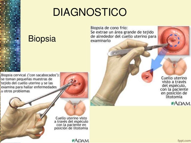 Sheynyy la osteocondrosis que calmar los dolores en el cuello