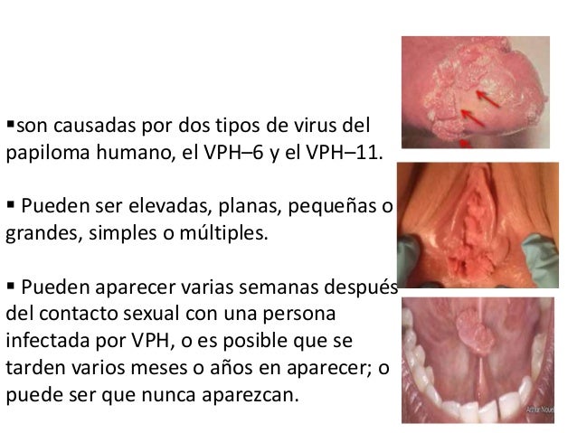 El medio la crema para el aumento del miembro viril