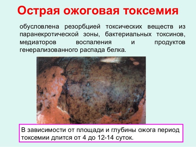Гингивит у детей: причины, симптомы, лечение, полоскания, гель Высокая температура без симптомов у взрослых