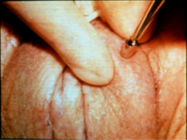Virginity to pregnant women Sex position fellatio