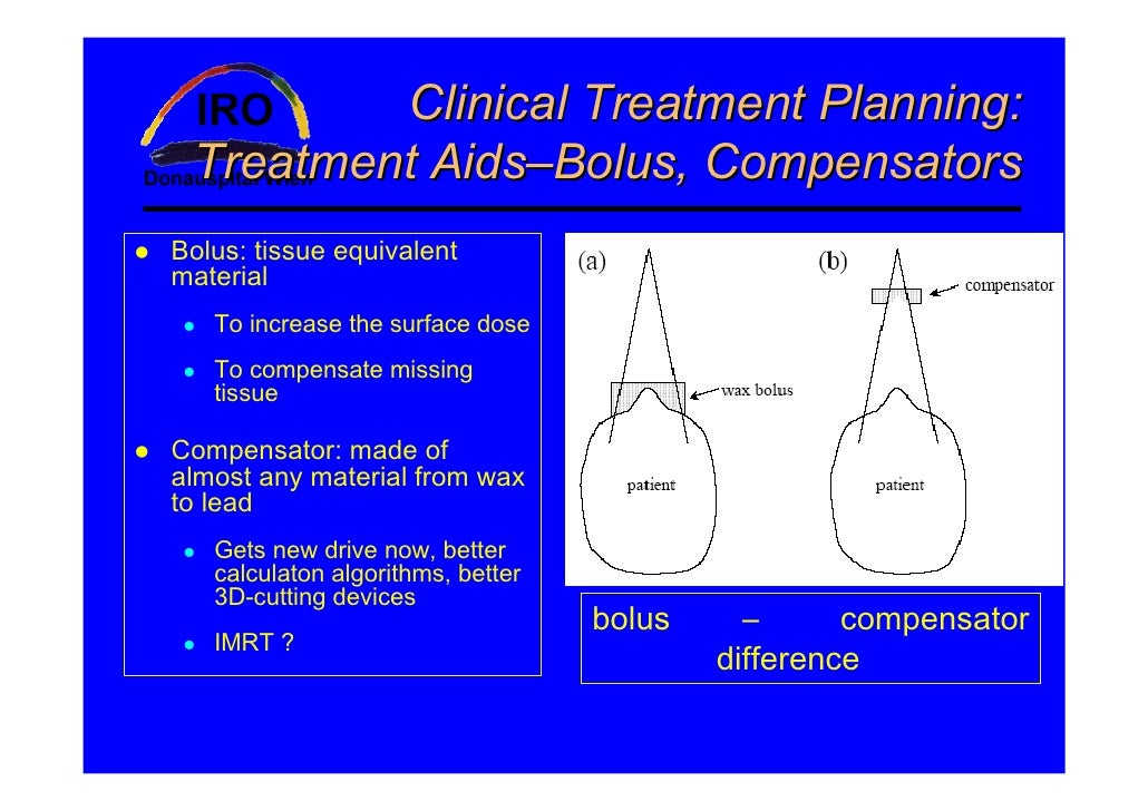 planning systems in radiotherapy
