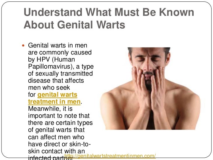 Genital Warts - Symptoms, Diagnosis, Treatment of Genital ...