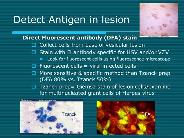 celexa side effects of celexa side effects of