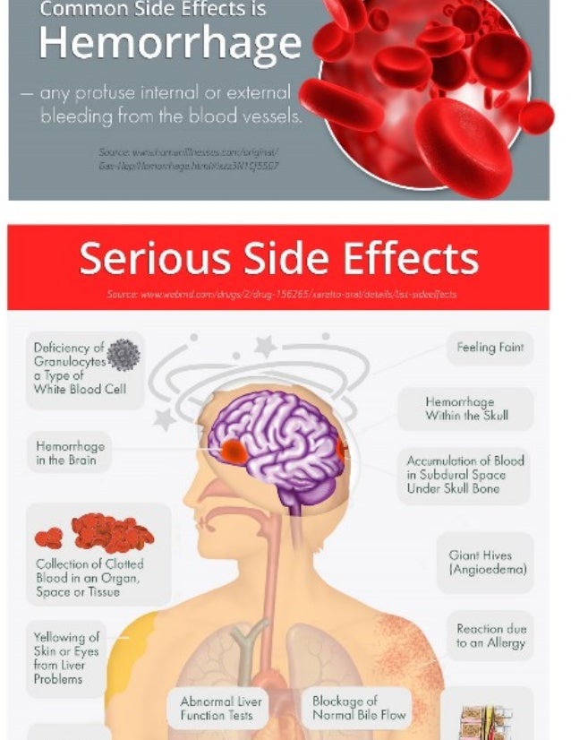 what-are-the-side-effects-of- ... what-are-the-side-effects-of- ...