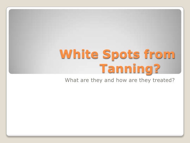 White Spots On Skin From Tanning