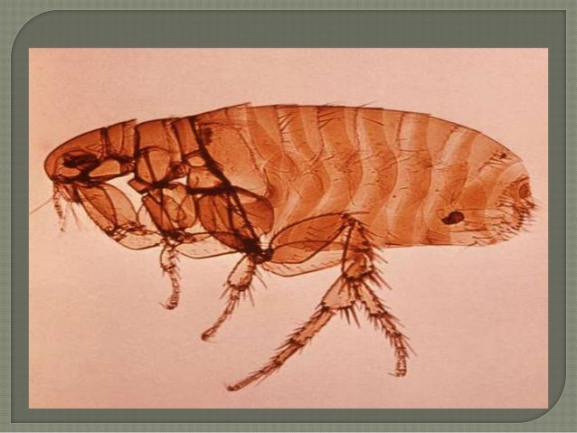 shakespeare and the bubonic plague The best known form is the bubonic plague and it is named after buboes, or enlarged, inflamed lymph nodes, which are characteristics of the plague in the groin or neck or armpit. shakespeare and the bubonic plague The best known form is the bubonic plague and it is named after buboes, or enlarged, inflamed lymph nodes, which are characteristics of the plague in the groin or neck or armpit.