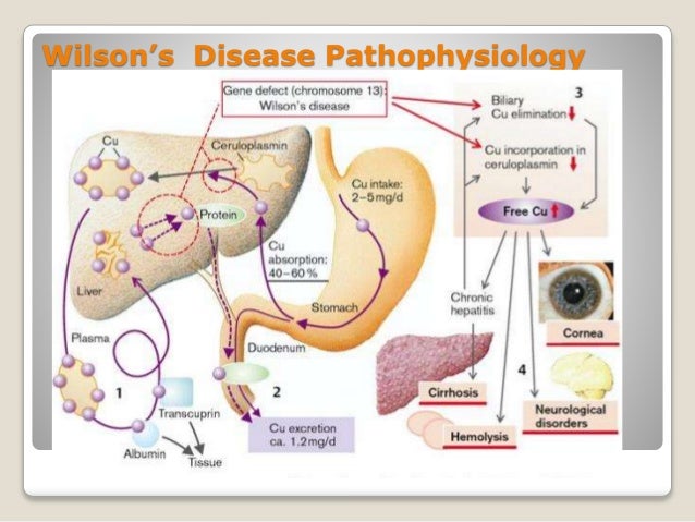 Wilson disease pathophysiology