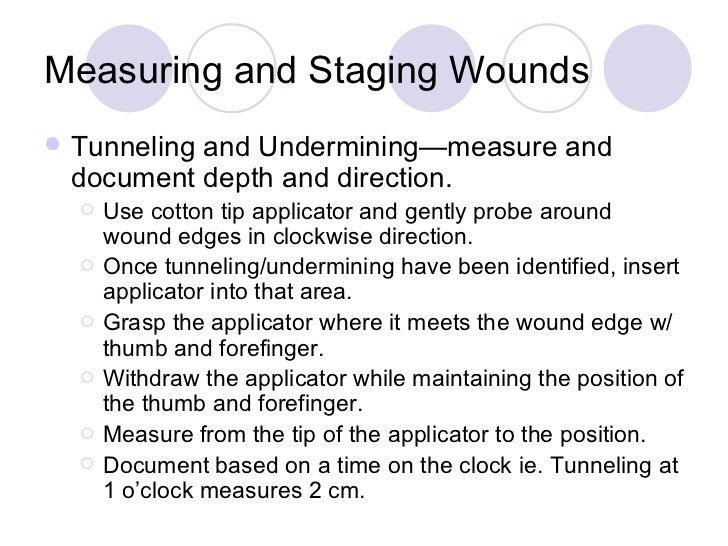 undermine defined undermine defined