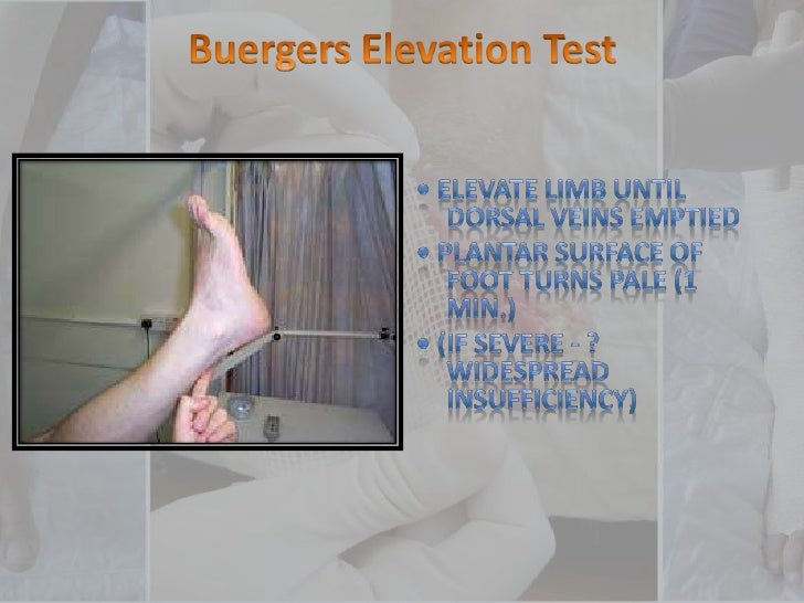 Diabetic Foot Examination