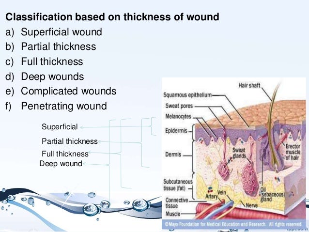 Partial Thickness Wounds Pictures Photos partial-thickness-wounds-pictures-photos