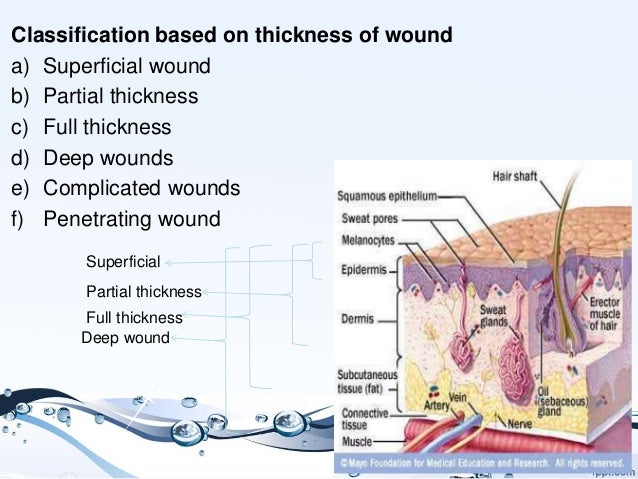 Wounds | DermNet New Zealand