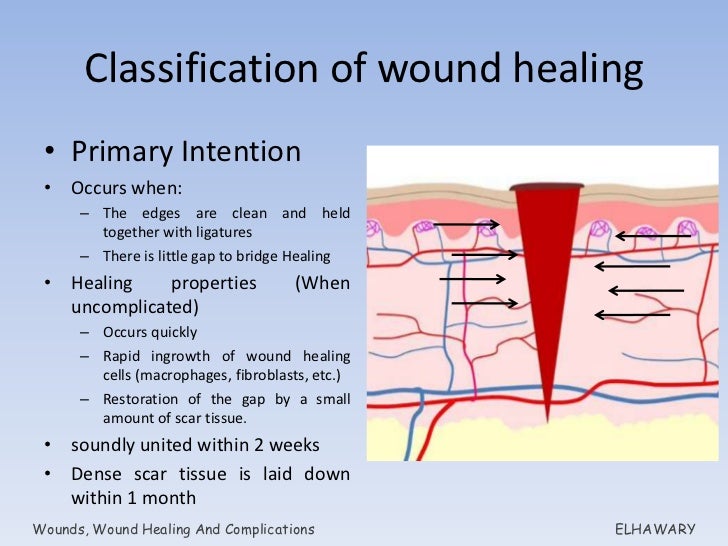 Wounds, wound healing and complications
