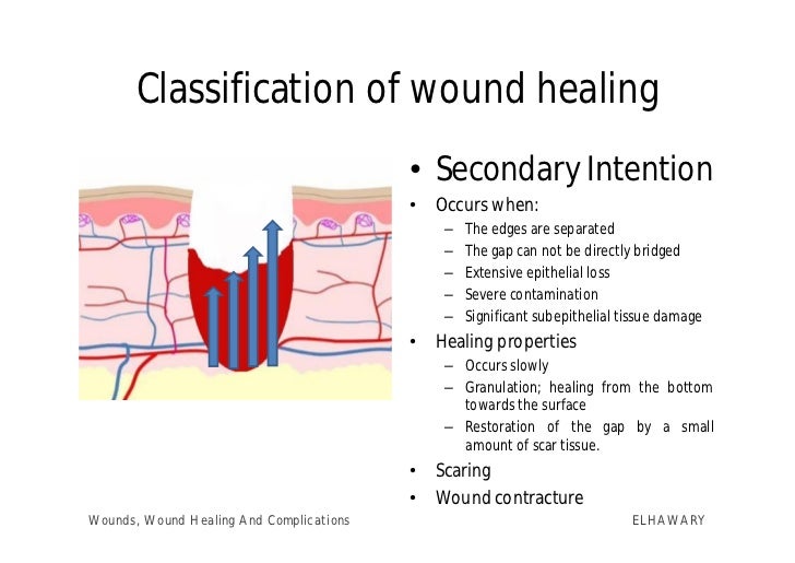 SECONDARY WOUND CLOSURE - Practical Plastic Surgery