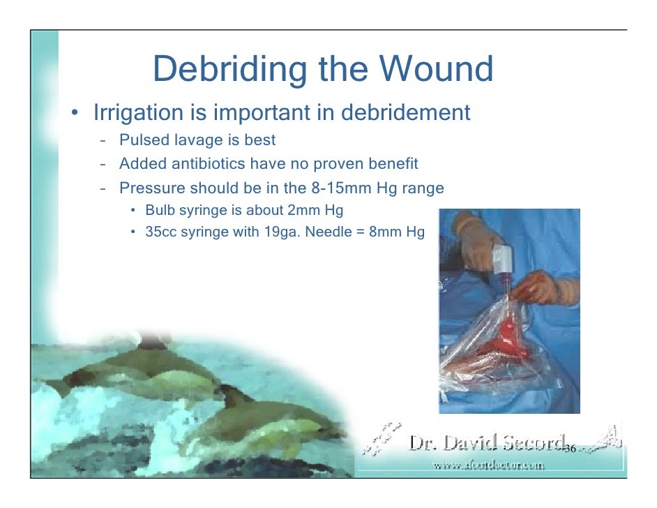 Wound Vac Lecture