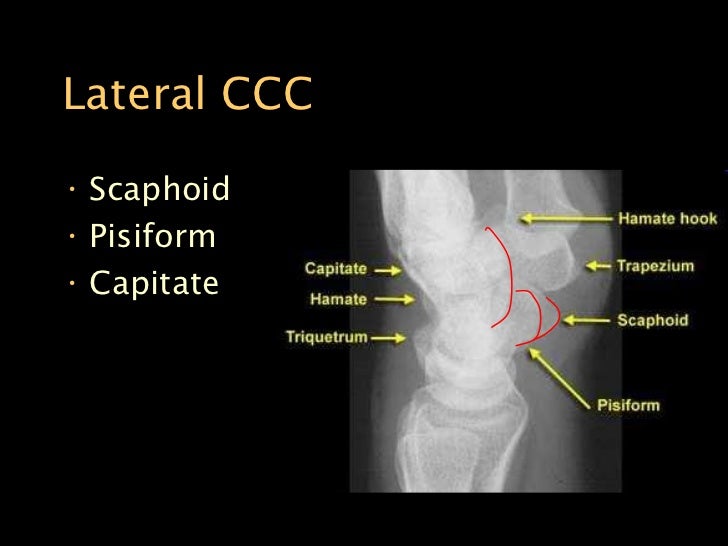 elbow xray