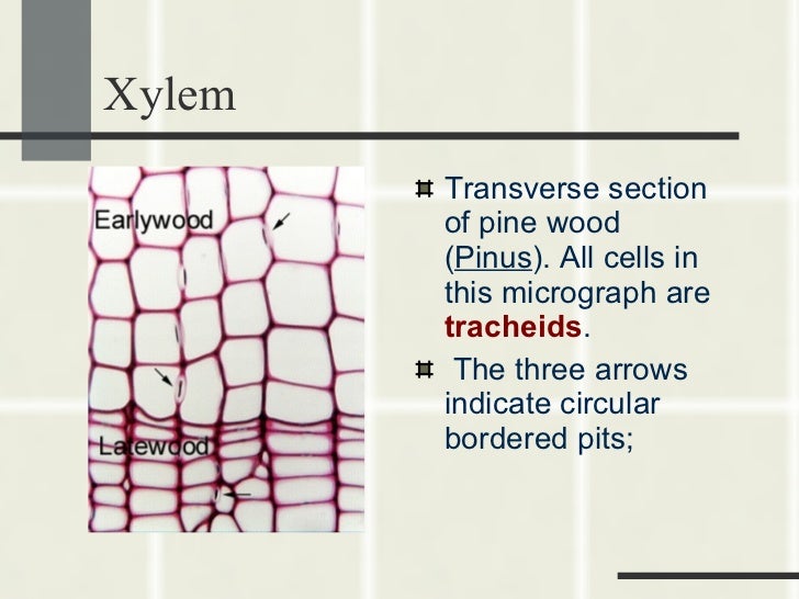 Tracheids Pits Vessel Elements Xylem Cells Diagram