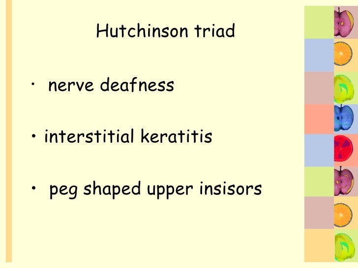 psychomotor retardation