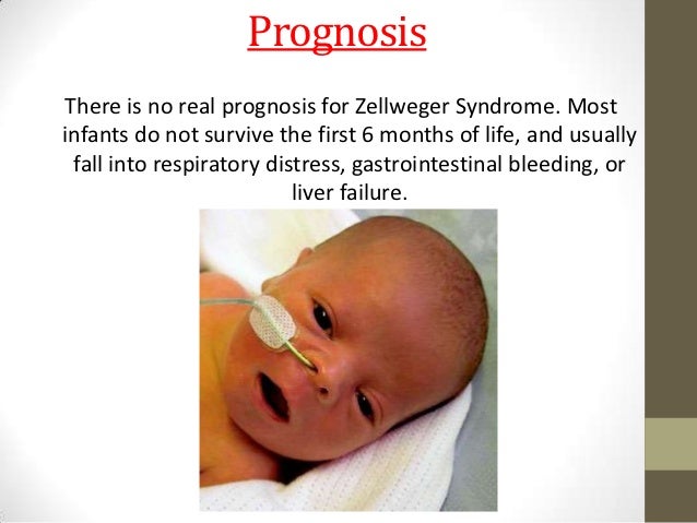 Hemorrhagic stroke eyes stroke prevention media