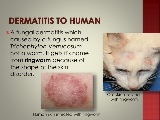 Skin Conditions In Humans Caused By Cats Skin Conditions In Humans Caused By Cats