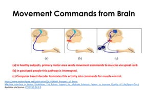 Movement Commands from Brain
(a) In healthy subjects, primary motor area sends movement commands to muscles via spinal cord.
(b) In paralyzed people this pathway is interrupted.
(c) Computer based decoder translates this activity into commands for muscle control.
https://www.researchgate.net/publication/262914980_Prospect_of_Brain-
Machine_Interface_in_Motor_Disabilities_The_Future_Support_for_Multiple_Sclerosis_Patient_to_Improve_Quality_of_Life/figures?lo=1
Available via license: CC BY-NC-SA 3.0
 