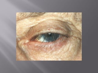 Introduction to ophthalmology | PPT