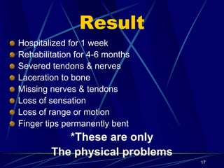 17
Result
Hospitalized for 1 week
Rehabilitation for 4-6 months
Severed tendons & nerves
Laceration to bone
Missing nerves & tendons
Loss of sensation
Loss of range or motion
Finger tips permanently bent
*These are only
The physical problems
 