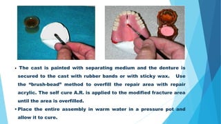 13- Relining, rebasing and repair of removable dentures.pptx
