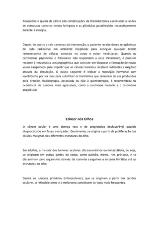 Rouquidão e queda de cálcio são complicações da tireoidectomia associadas a lesões 
de estruturas como os nervos laríngeos e as glândulas paratireoides respectivamente 
durante a cirurgia. 
Depois de quatro a seis semanas da intervenção, o paciente recebe doses terapêuticas 
de iodo radioativo em ambiente hospitalar para extinguir qualquer tecido 
remanescente de células tumorais no corpo e evitar metástases. Quando os 
carcinomas papilíferos e foliculares não respondem a esse tratamento, é possível 
recorrer à terapêutica antiangiogênica que consiste em bloquear a formação de novos 
vasos sanguíneos para impedir que as células tumorais recebam nutrientes e oxigênio 
através da circulação. O passo seguinte é indicar a reposição hormonal com 
levotiroxina por via oral para substituir os hormônios que deixaram de ser produzidos 
pela tireoide. Radioterapia, associada ou não à quimioterapia, é recomendada na 
ocorrência de tumores mais agressivos, como o carcinoma medular e o carcinoma 
anaplásico. 
Câncer nos Olhos 
O câncer ocular é uma doença rara e de prognóstico desfavorável quando 
diagnosticado em fases avançadas. Geralmente, se origina a partir da proliferação das 
células malignas nas diferentes estruturas do olho. 
Em adultos, a maioria dos tumores oculares são secundários ou metastáticos, ou seja, 
se originam em outras partes do corpo, como pulmão, mama, rim, próstata, e se 
disseminam pelo organismo através da corrente sanguínea e sistema linfático até as 
estruturas do olho. 
Dentre os tumores primários (intraoculares), que se originam a partir dos tecidos 
oculares, o retinoblastoma e o melanoma constituem os tipos mais frequentes. 
 